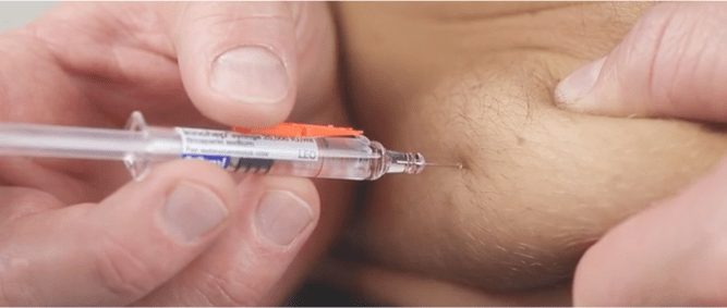 Thrombose-Spritze wird in Bauchfalte eingeführt. 